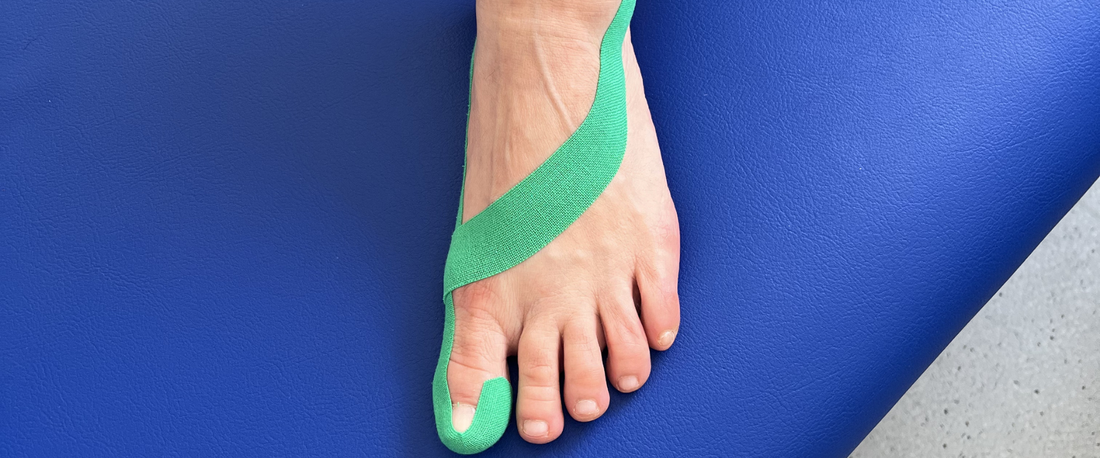 Trápí vás vbočený palec? Zjistěte, jak mu předcházet a proč mohou barefoot boty změnit váš život